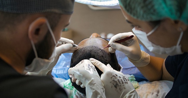 Fra skaldethed til fyldigt hår: Succesfulde hårtransplantationer til mænd